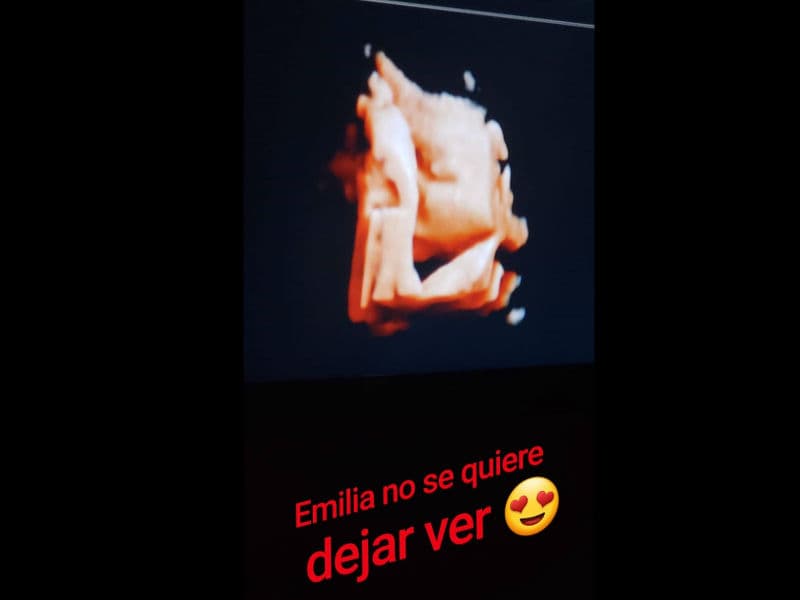 Paula y Emilia nacerán a mediados de diciembre