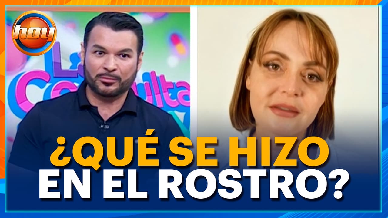 Especialista explica el tratamiento qué se hizo Gabriela Spanic en la cara