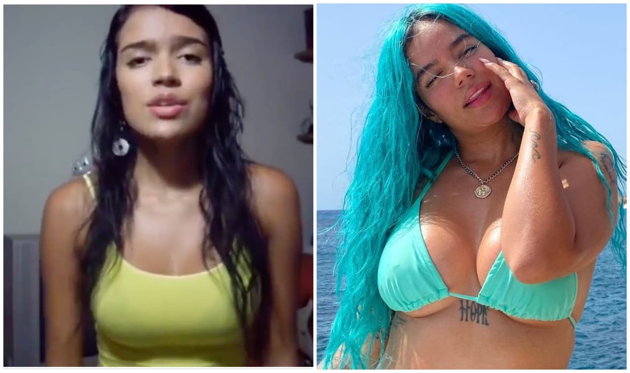 Karol G: los 'arreglitos' que ha admitido que se ha hecho