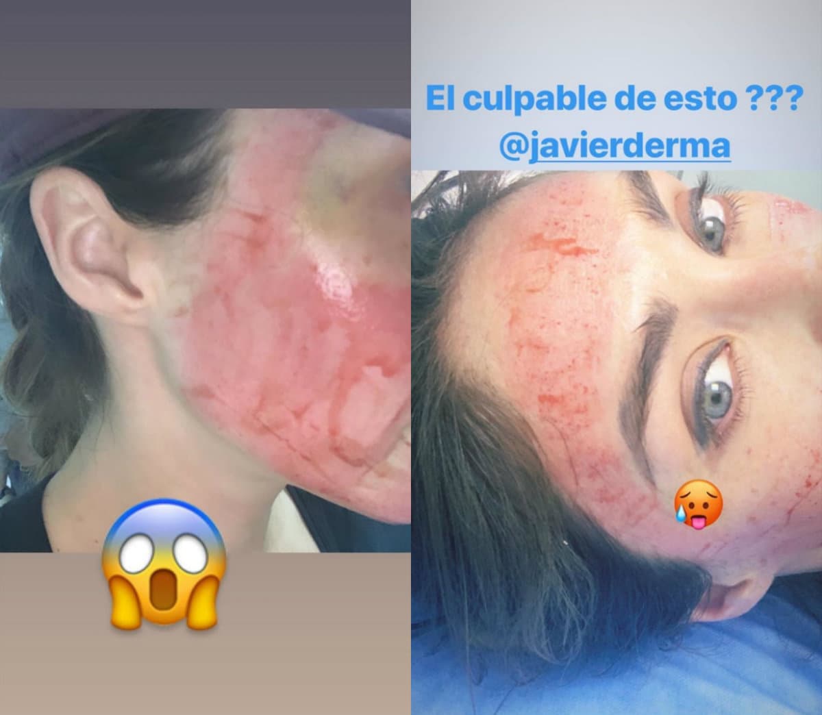 Anahí publicó las fotografías de su tratamiento estético en Instagram