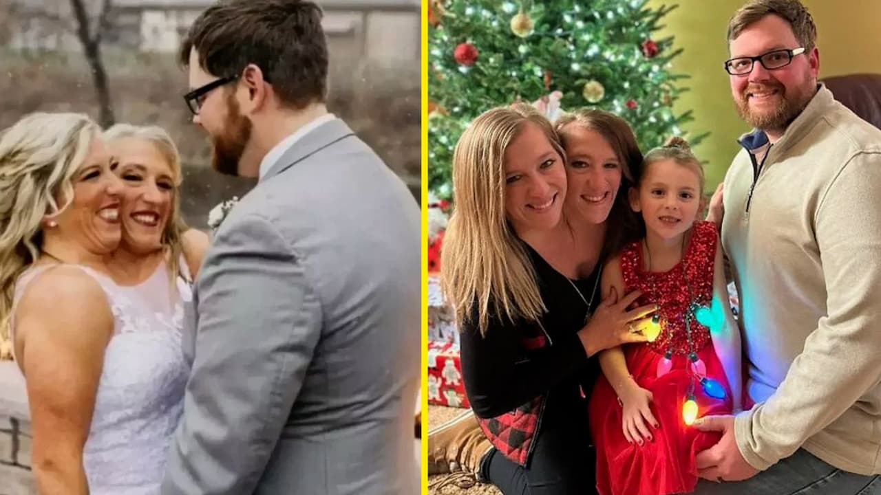 ¿Las famosas siamesas Abby y Brittany Hensel podrían tener bebés ahora que una de ellas se casó?