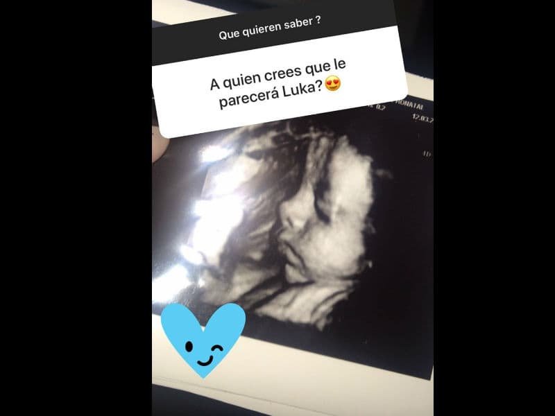 La actriz compartió la imagen, cuando le cuestionaron a quién creía que se parecerá su hijo Luka