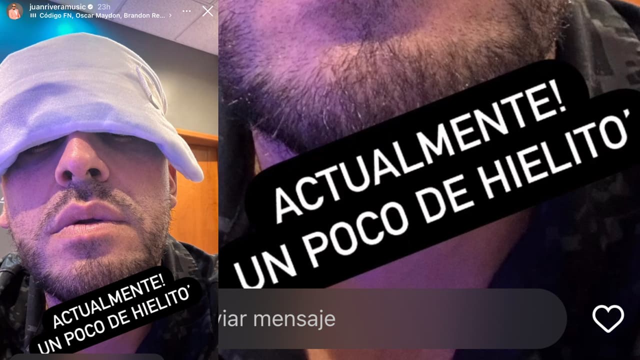 Juan Rivera mostró cómo se cuida en la convalecencia tras el injerto capilar al que se sometió.