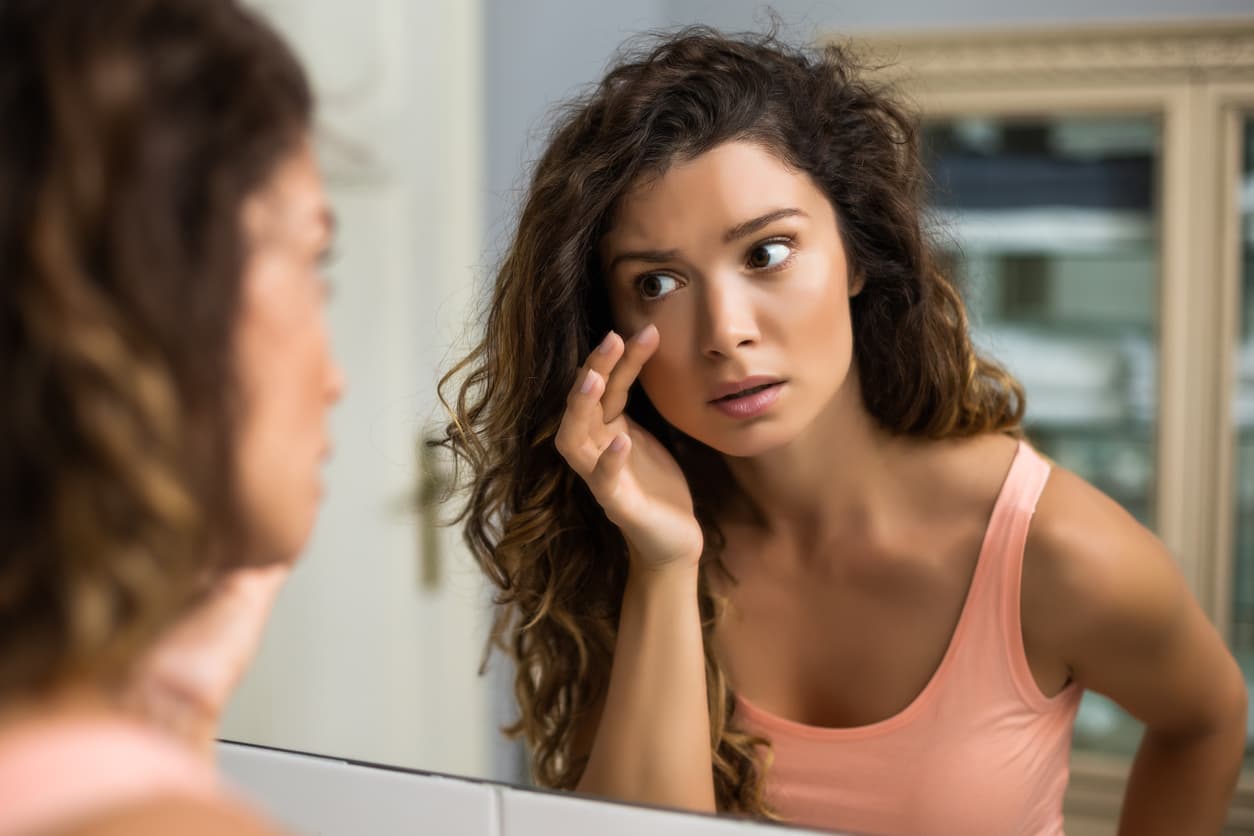 ¿Cómo me quito las ojeras?