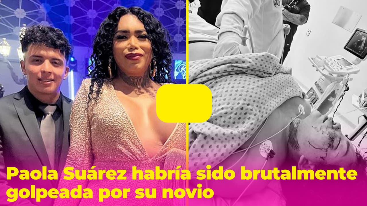 Paola Suárez de 'Las Perdidas' podría perder el ojo: habría sido brutalmente golpeada por su novio