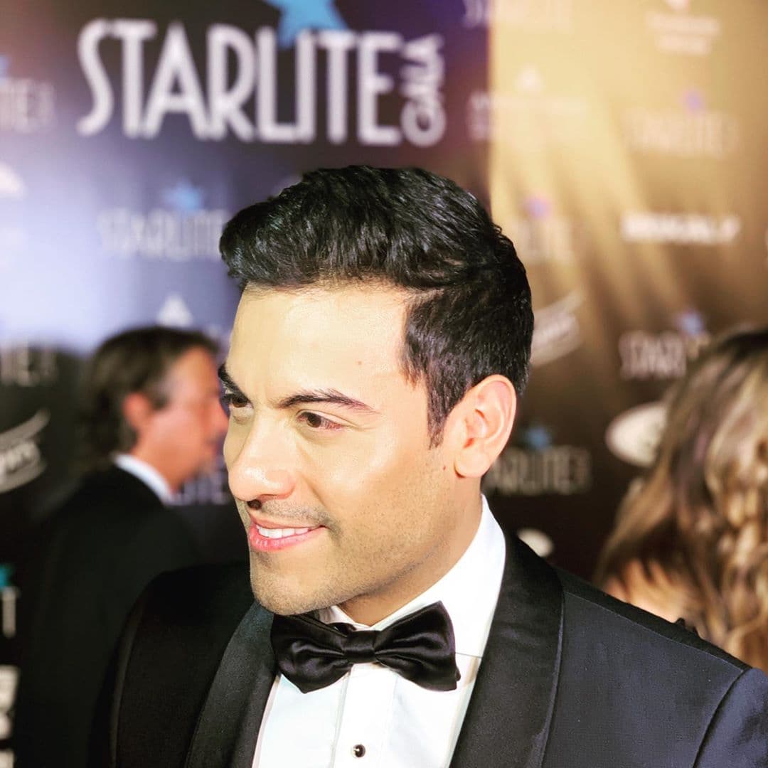 Carlos Rivera es una de las figuras más populares de la música pop en México. Sin embargo, él muestra las características de su rostro que usualmente las tiene que esconder y lo hace con orgullo.