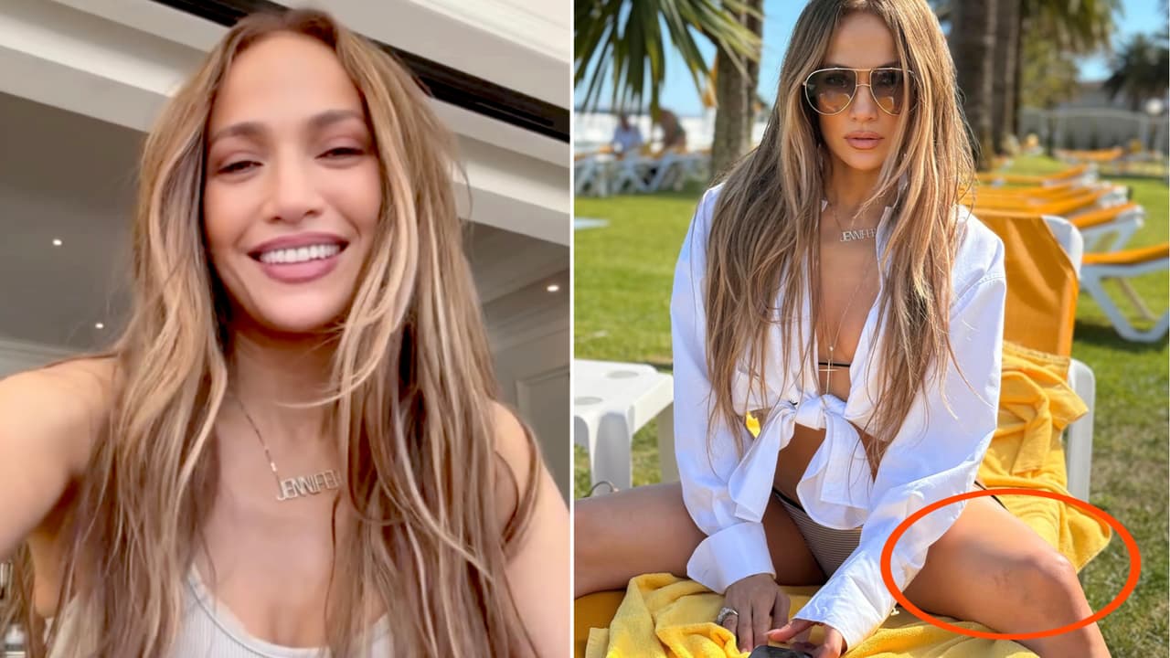 JLo aparece en bikini y preocupa por detalle en sus piernas: ¿moretones?