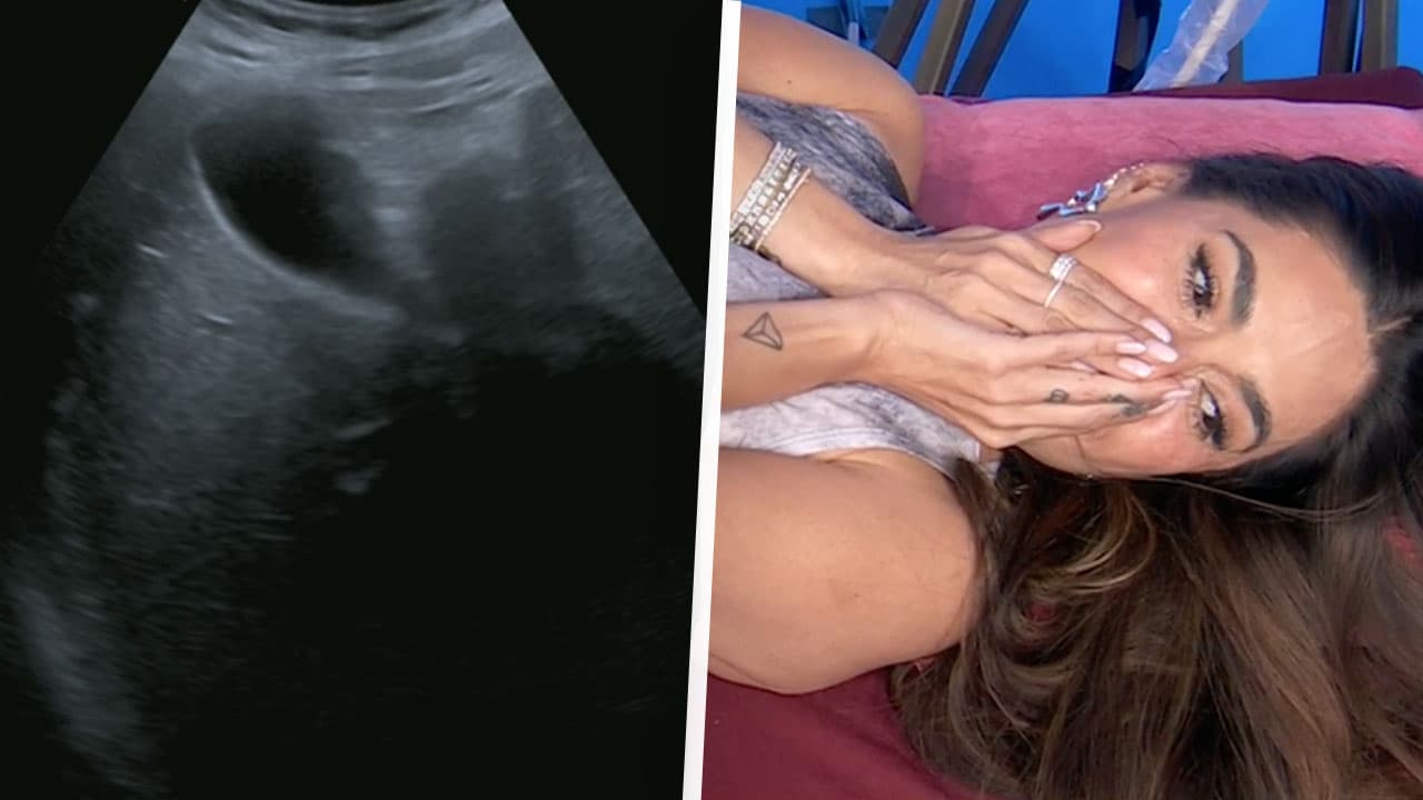 Galilea Montijo encuentra algo inesperado en el ultrasonido que se hizo en VIVO
