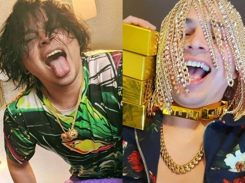 Rapero se quita el pelo y se implanta en el cráneo cadenas de oro de 70 millones de pesos