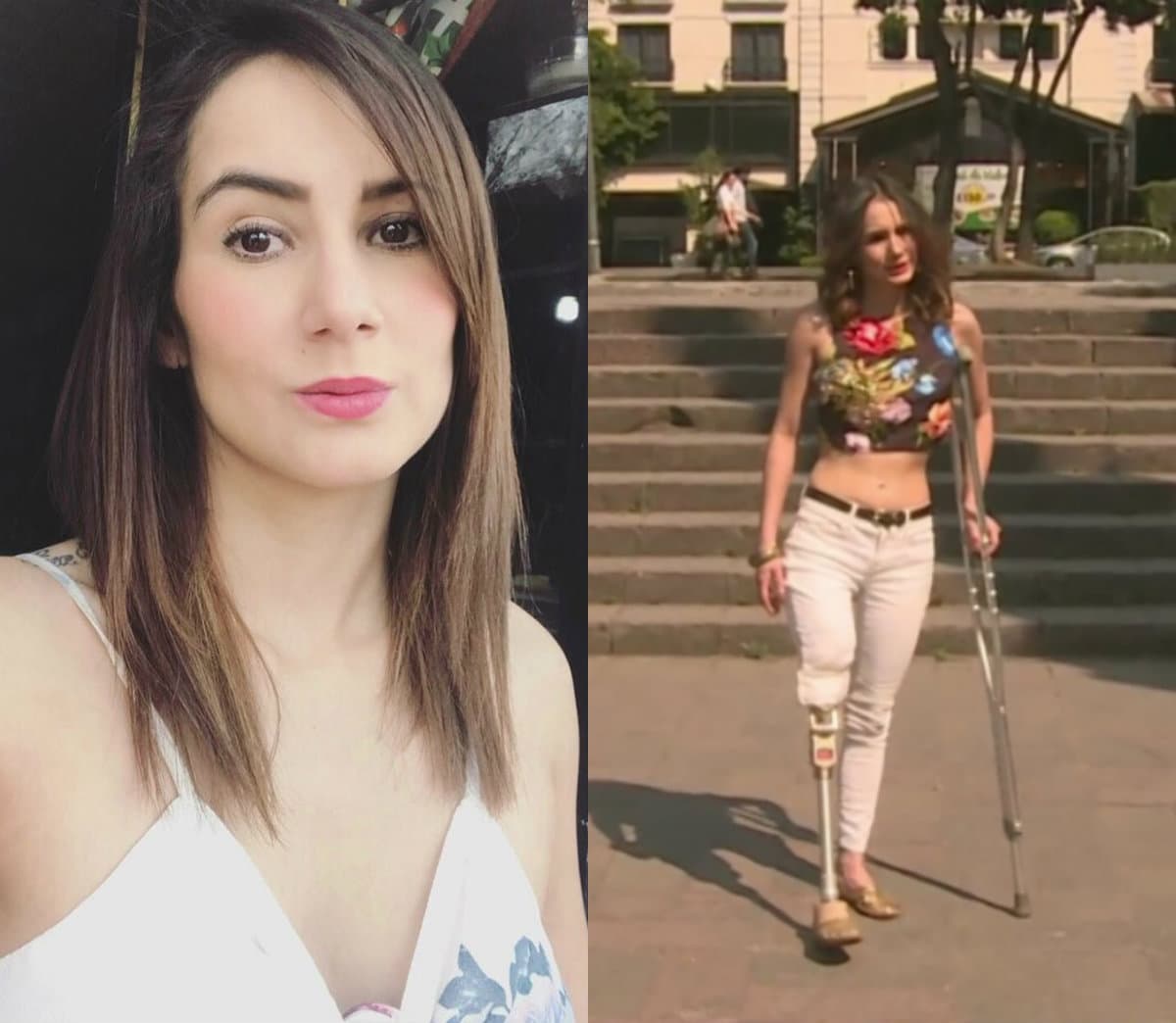 Modelo narra cómo por una inyección mal puesta le amputaron la pierna en una clínica mexicana