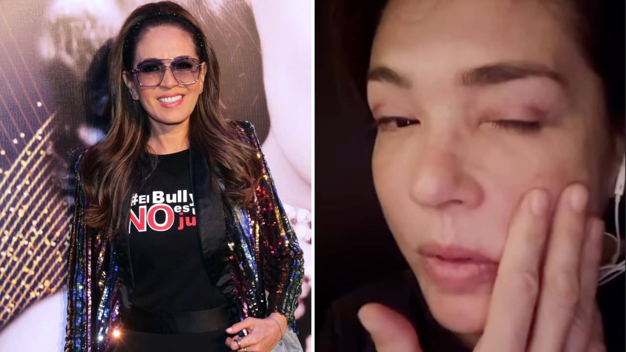 Yolanda Andrade impacta al mostrar su deterioro físico tras ser diagnosticada con ELA; manda conmovedor mensaje