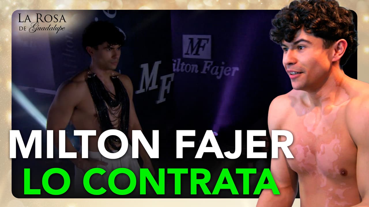 Joaquín ya no oculta su vitiligo y se vuelve el modelo principal de Milton Fajer