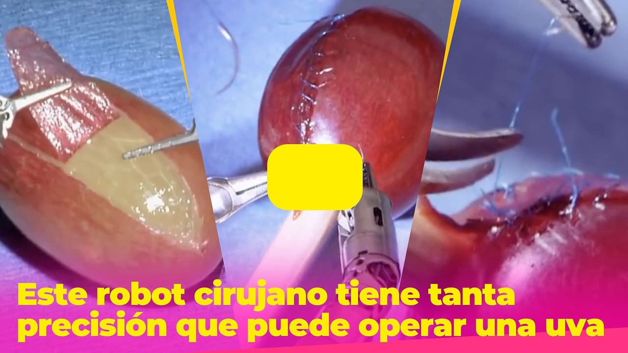 Este robot cirujano tiene tanta precisión que puede operar una uva: no podrás dejar de verlo