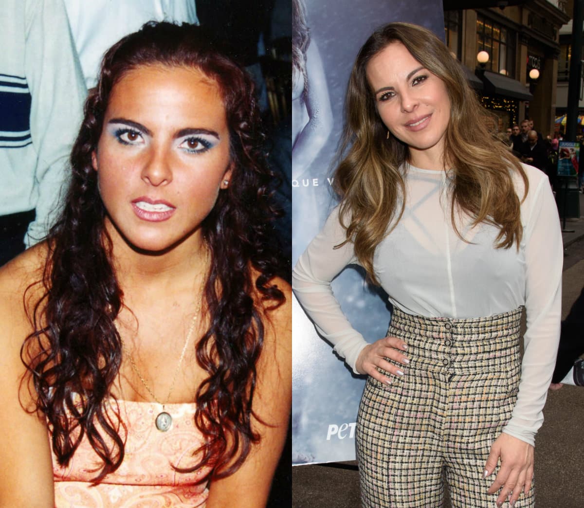 Entre los tratamientos estéticos que aseguran se realiza Kate del Castillo están las inyecciones de botox