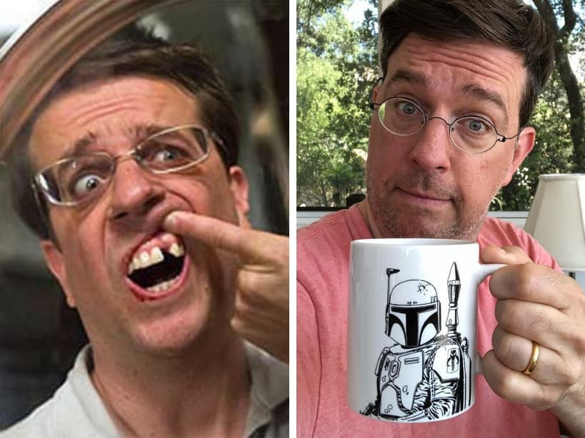 Ed Helms. Aunque no perdió ninguno, al actor le hace falta un diente debido a una deformidad genética, por lo cual ha llevado un implante desde que cumplió 15 años. Sin embargo, en 2009 decidió quitarlo para la película “¿Qué paso ayer?”.