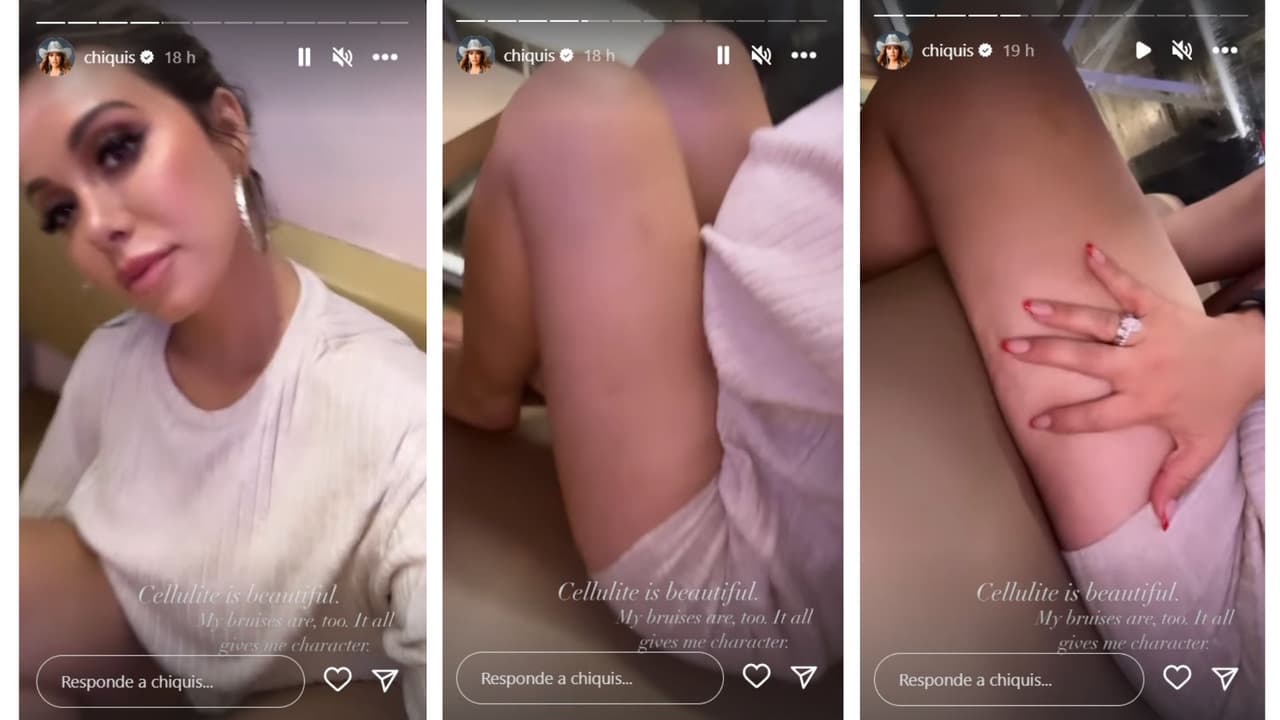 Chiquis Rivera mostró que tiene celulitis y moretones en su muslo.