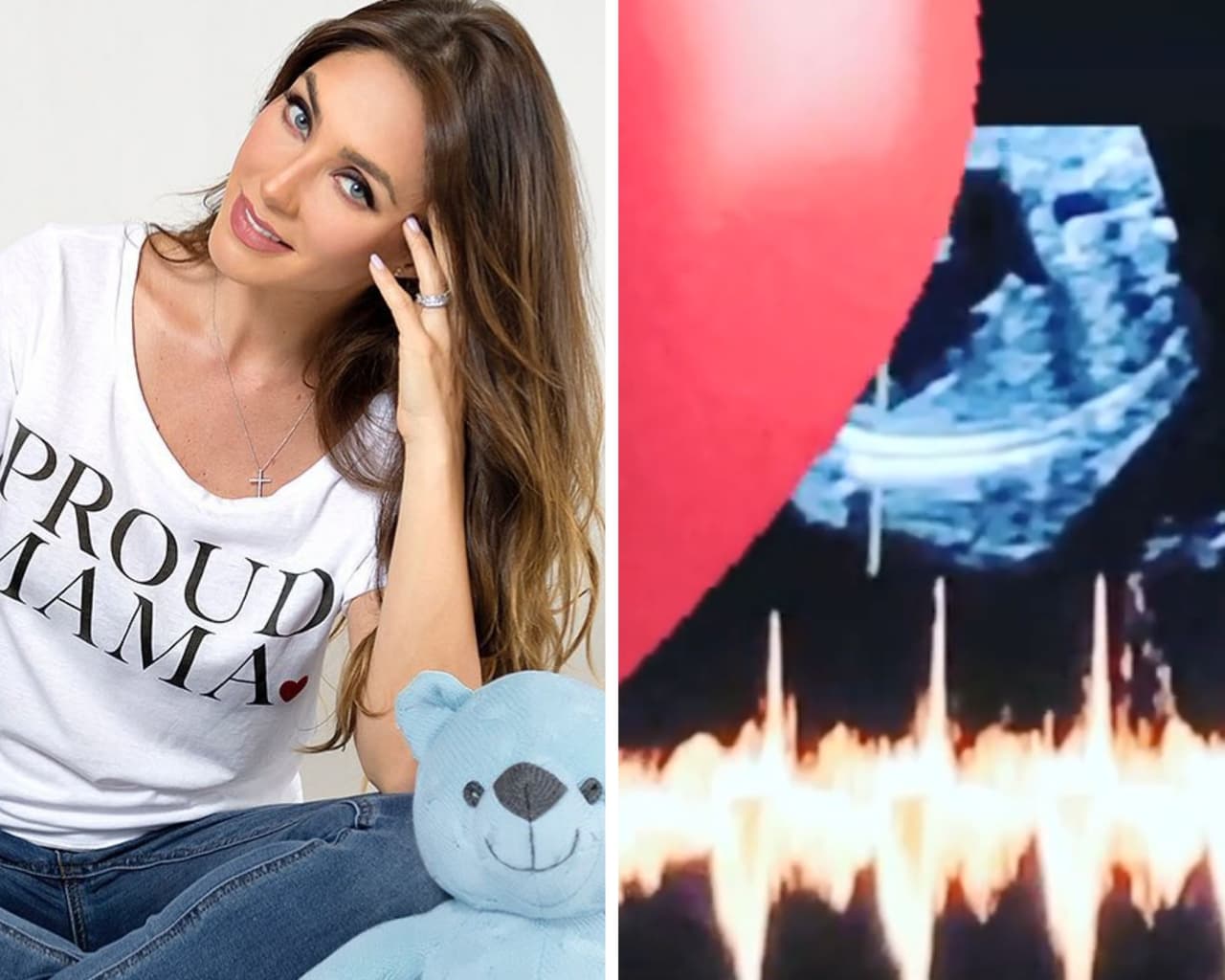 Anahí comparte video en el que se escucha el corazón latiendo de su futuro bebé, Emiliano
