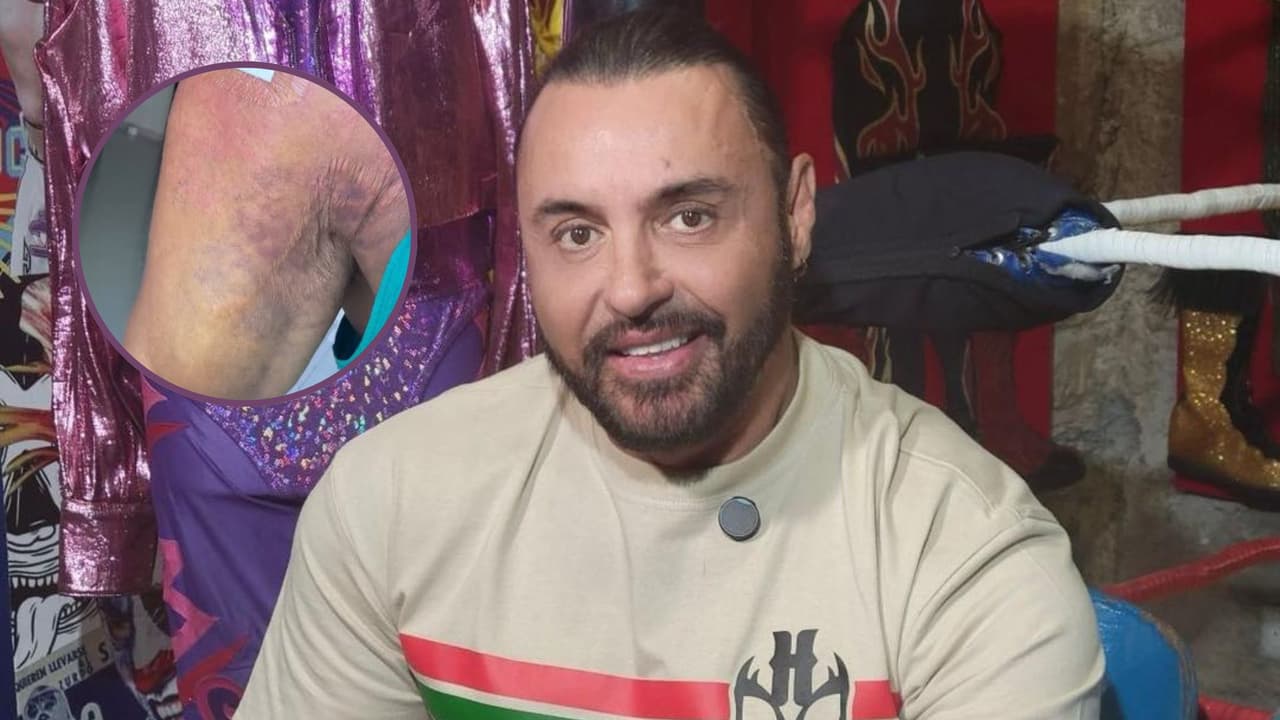 Tras sufrir una fuerte golpiza, Latin Lover revela detalles de su cirugía y muestra cómo luce su hombro