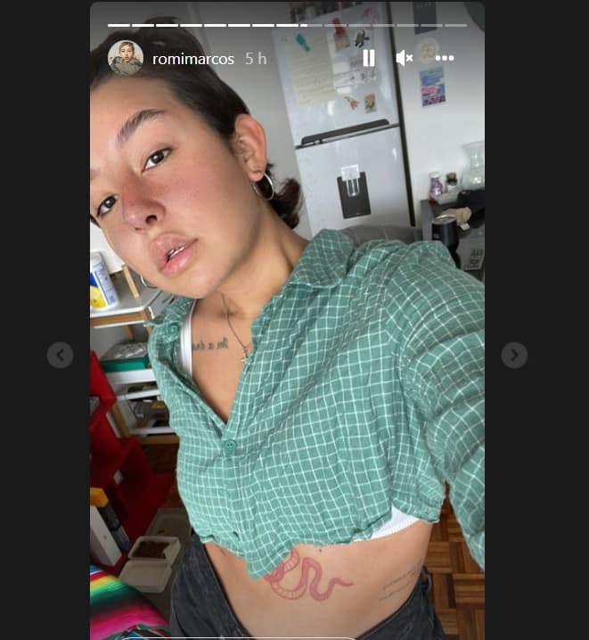 Así luce Romi Marcos tras cirugía