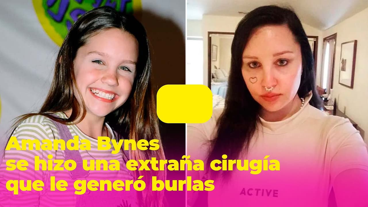 ¿Qué le pasó a Amanda Bynes en el rostro? Una extraña cirugía le cambió la cara