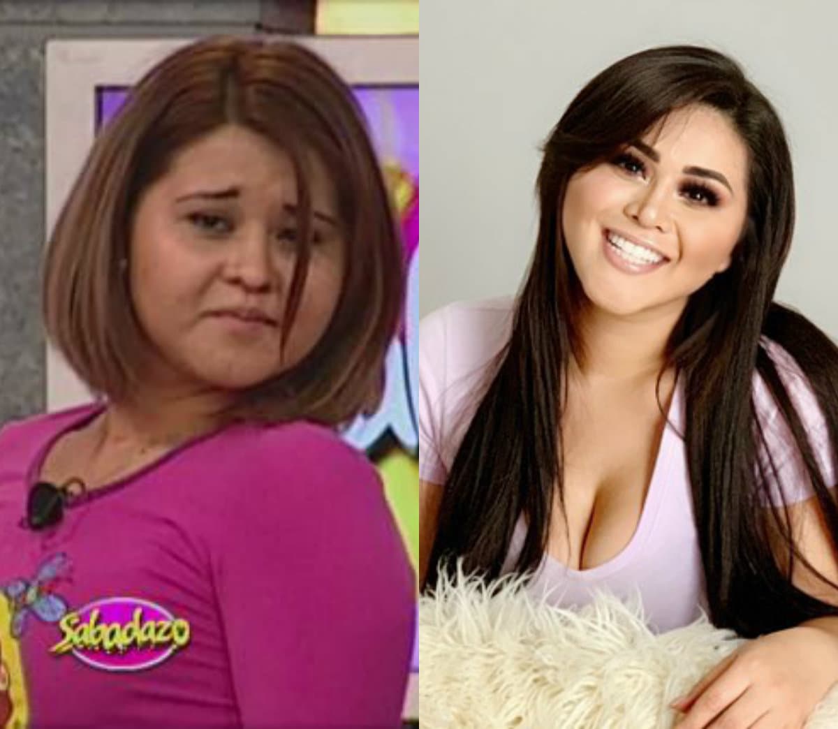 Gomita es un libro abierto y desde que saltó a la fama en el programa ‘Sabadazo’ habló sin tapujos de las cirugías plástica que se realizó para lucir espectacular.