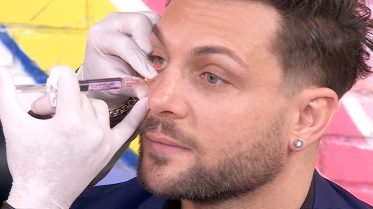 Nicola Porcella se somete a tratamiento EN VIVO para eliminar las ojeras