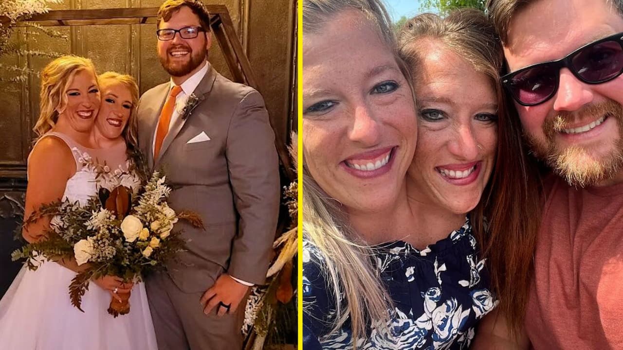 ¿Quién es el hombre con el que se casó la famosa siamesa Abby Hensel? Esta es su historia
