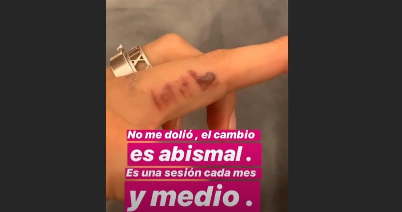 Instagram @michellerenaud