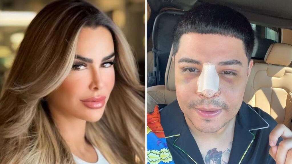 Ninel Conde reacciona a comparaciones con Eduin Caz por supuesto exceso de bótox del cantante