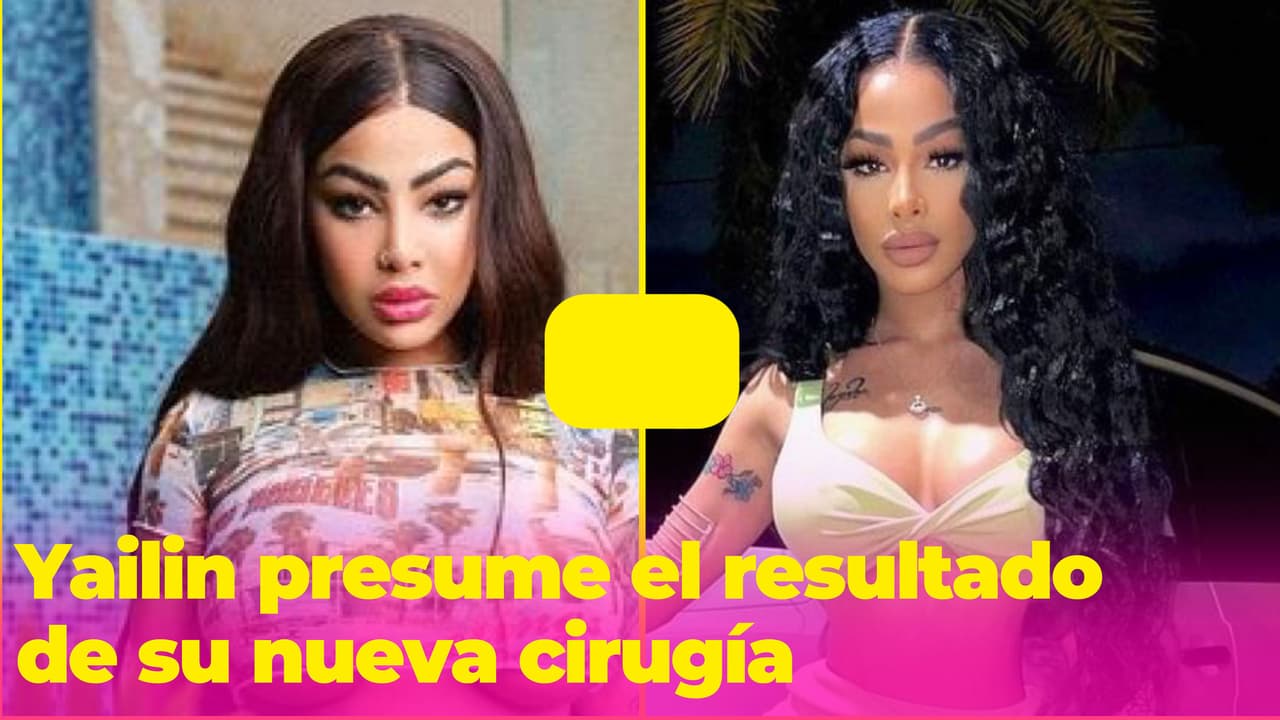 Yailin presume el resultado de su nueva cirugía a casi 4 meses de haber dado a luz