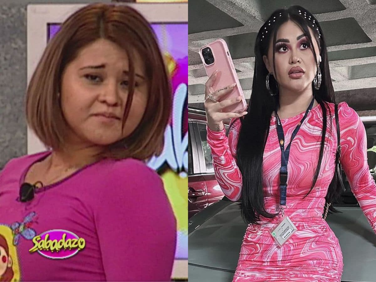 Gomita y su impresionante transformación: de ser payasita en ‘Sabadazo’ a su última cirugía