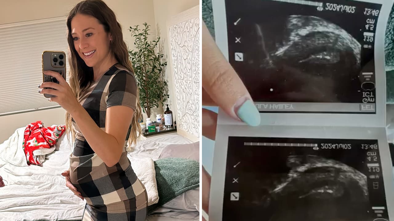 Muere famosa influencer poco después de dar a luz a su bebé, luchó años por tenerlo