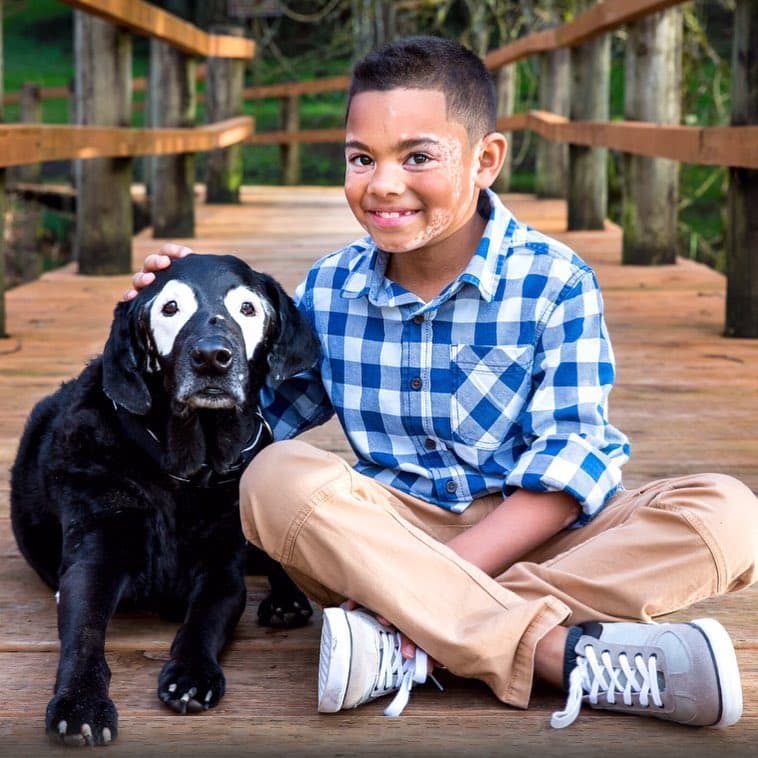 La historia del niño y el perro con vitiligo que conmueve las redes sociales