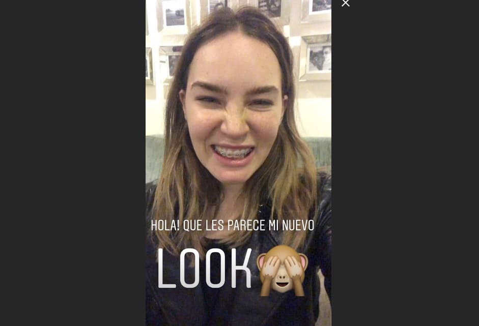 Belinda lució brakets
