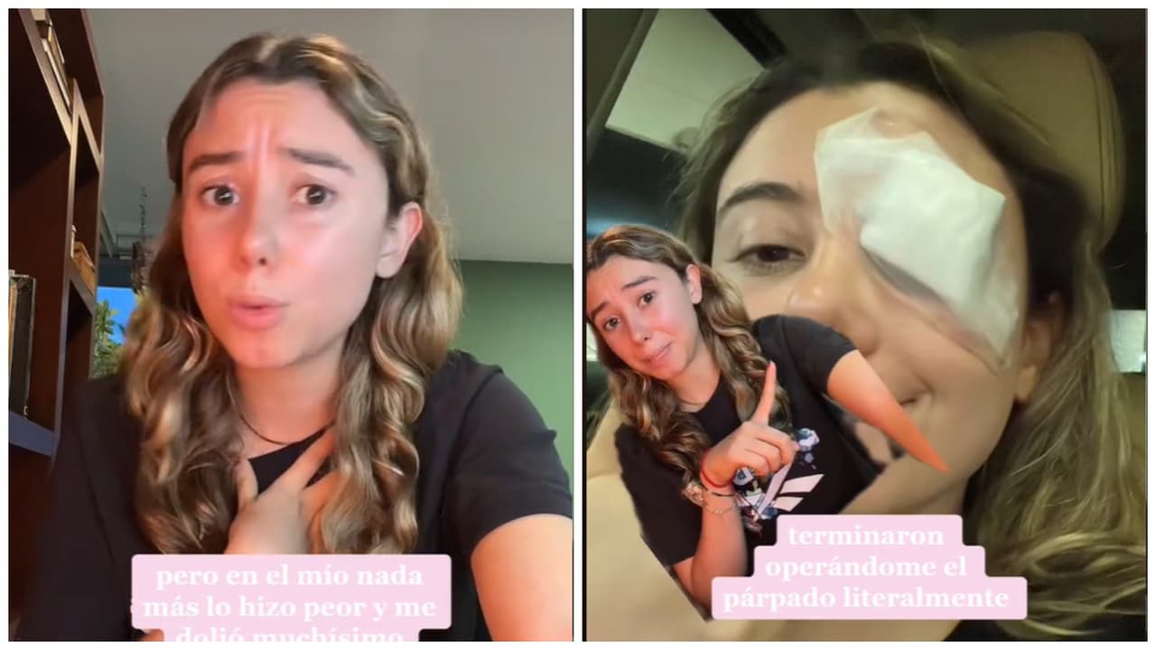 Joven termina en el quirófano por "truco de belleza" que vio en TikTok: video viral