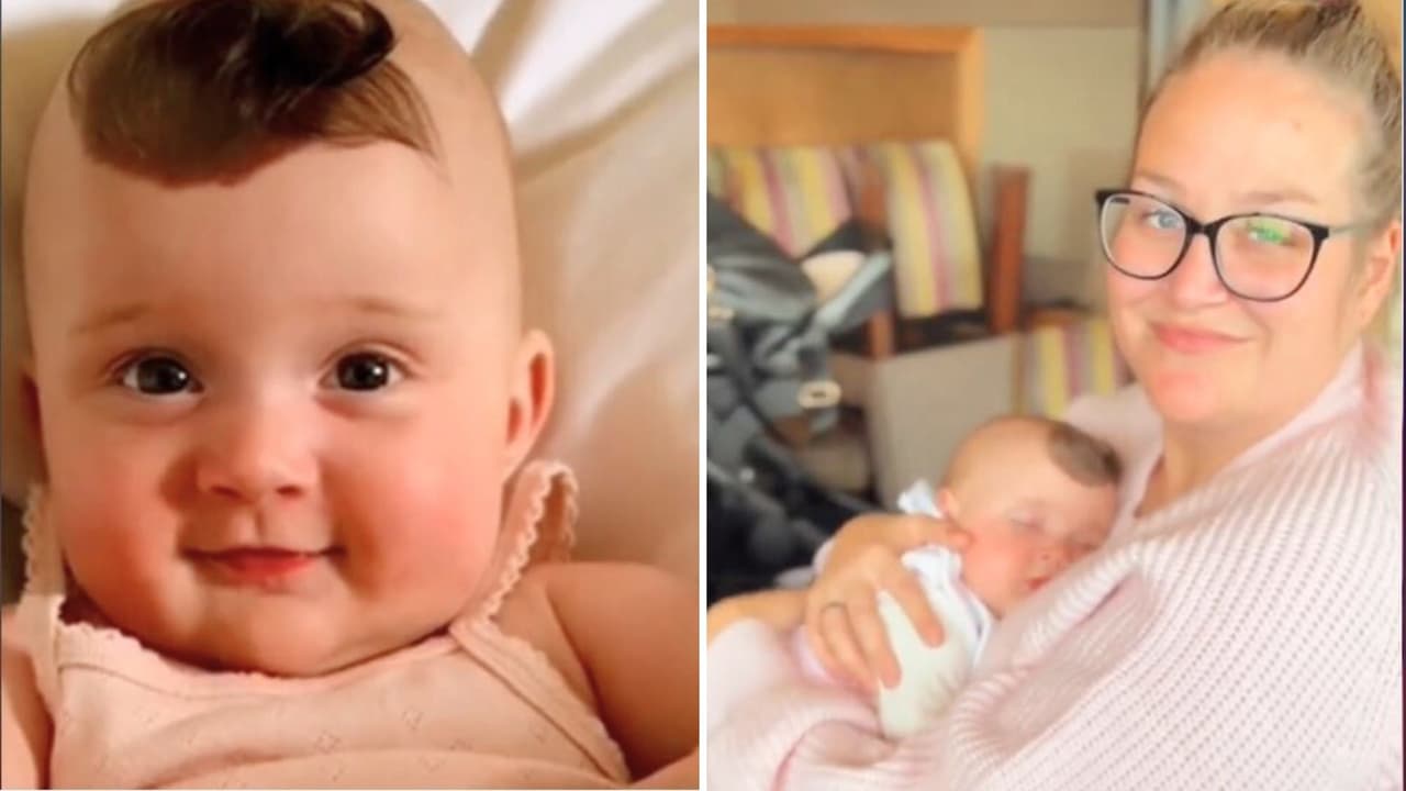 'Bebé unicornio' nace con una marca en la frente y su mamá la defiende de las críticas