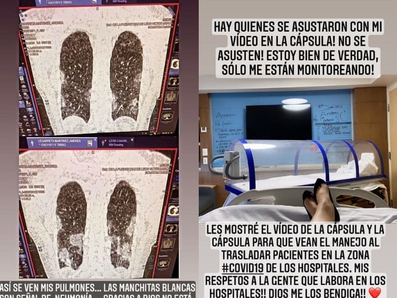 La conductora compartió una imagen de las placas que le tomaron a sus pulmones para comprobar los daños de la nemonía que le dejó el Covid-19.