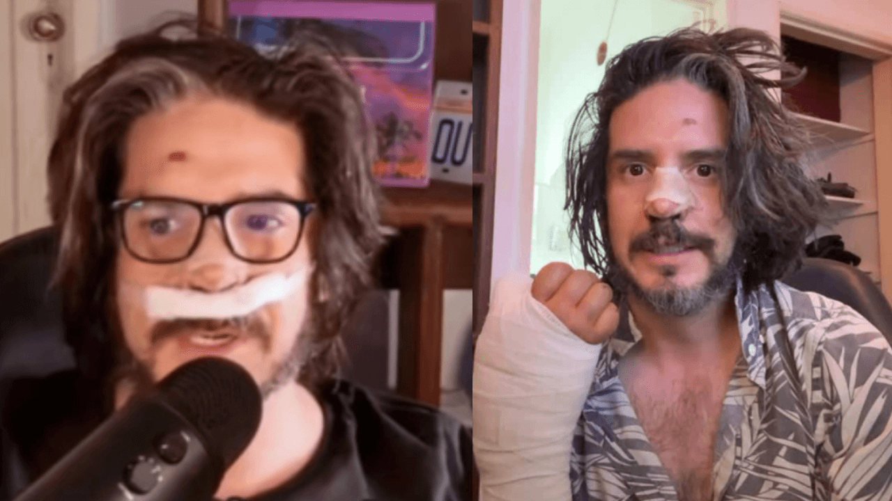 Famoso conductor mexicano aparece con el rostro desfigurado: devastado, destapa en video lo que sufrió