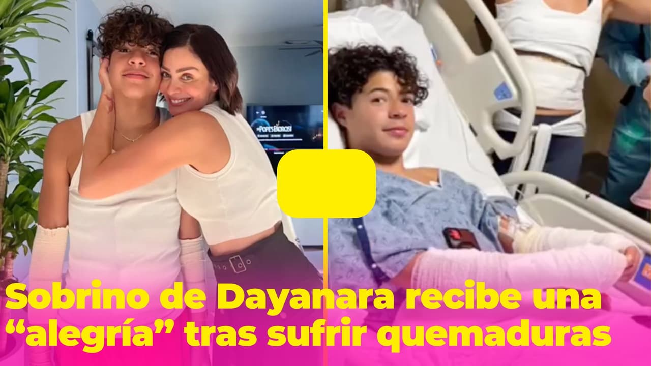 Sobrino de Dayanara Torres recibe una "alegría" tras sufrir quemaduras por una explosión