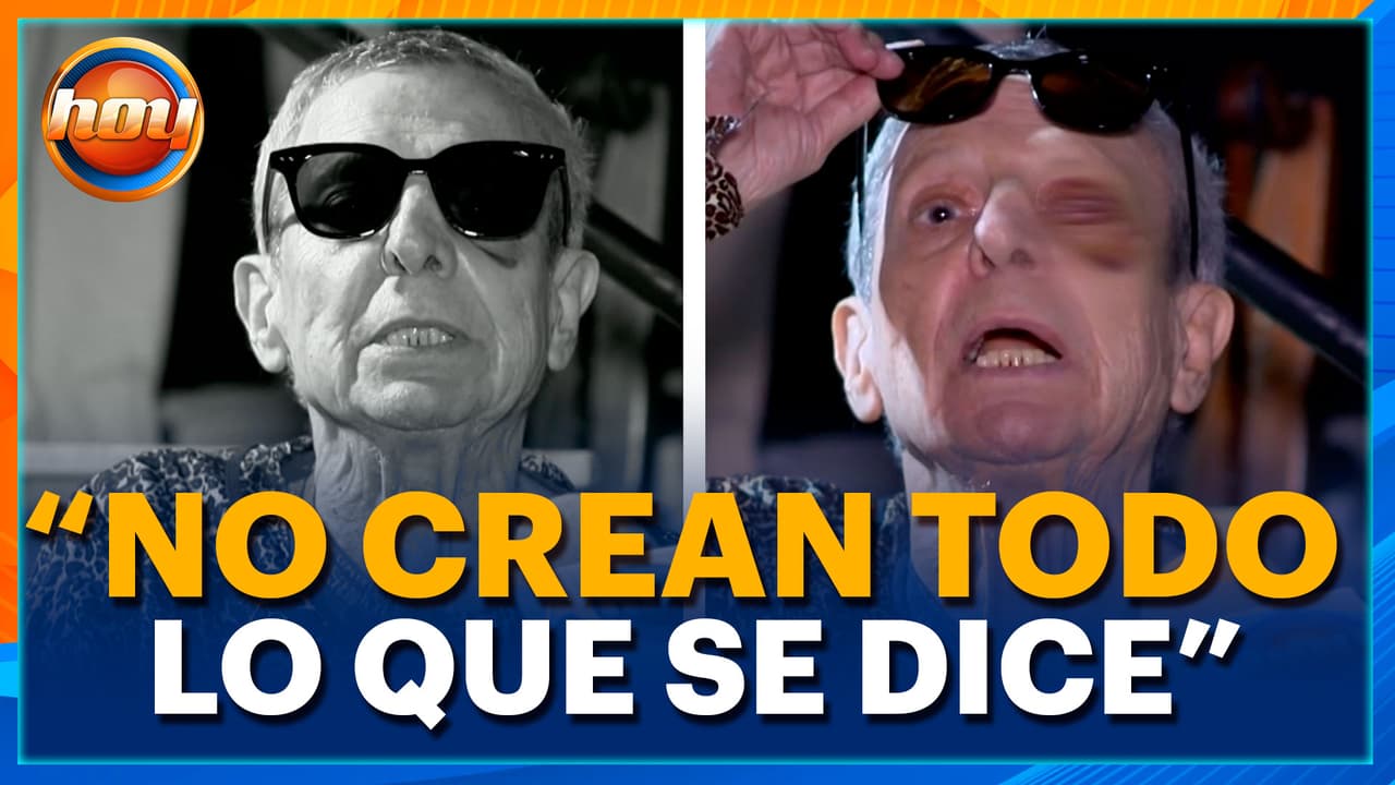César Bono NIEGA haber perdido un ojo y REACCIONA a lo sucedido al ‘Flaco’ Ibáñez