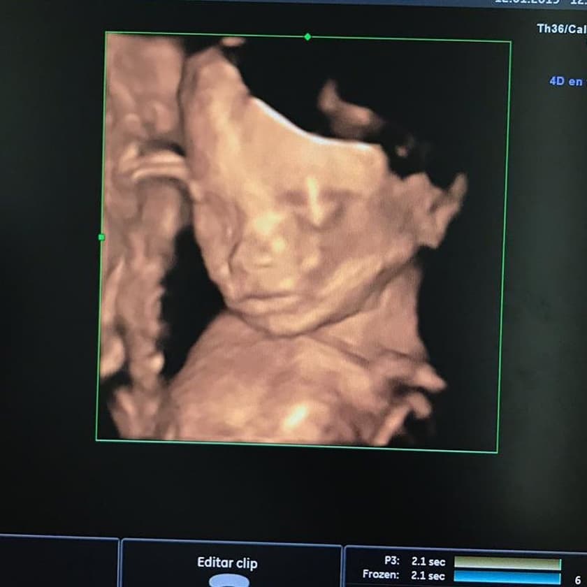 La pareja continuó nutriendo su relación y el 15 de enero de 2019 anunciaron en redes que esperaban su primera hija. “Mi esposo y yo sentimos una felicidad infinita, se está cumpliendo el sueño más grande de los dos, esta es la mejor bendición que la vida nos pudo dar y lo que pueda decir se queda corto a lo que sentimos”, expresó Ingrid.