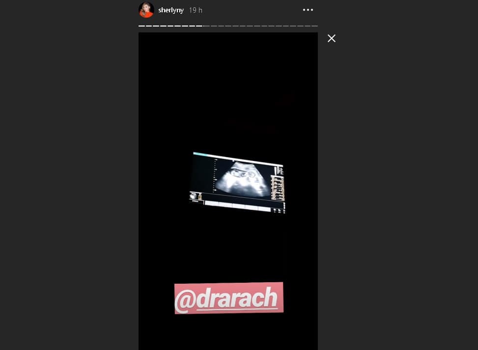 Sherlyn mostró su último ultrasonido