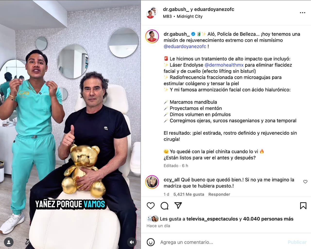 Eduardo Yáñez se somete a tratamiento para rejuvenecer.