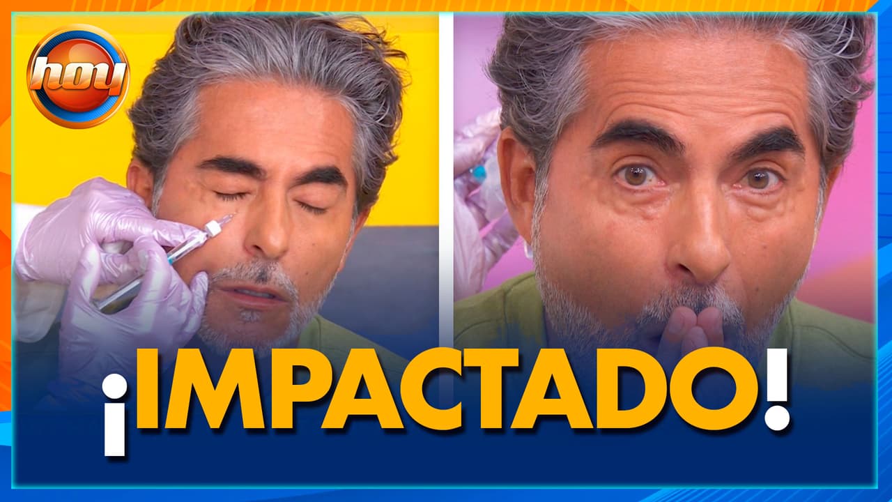 Raúl Araiza se hace RETOQUE estético en vivo… ¡y su reacción al ver el resultado lo dice todo!