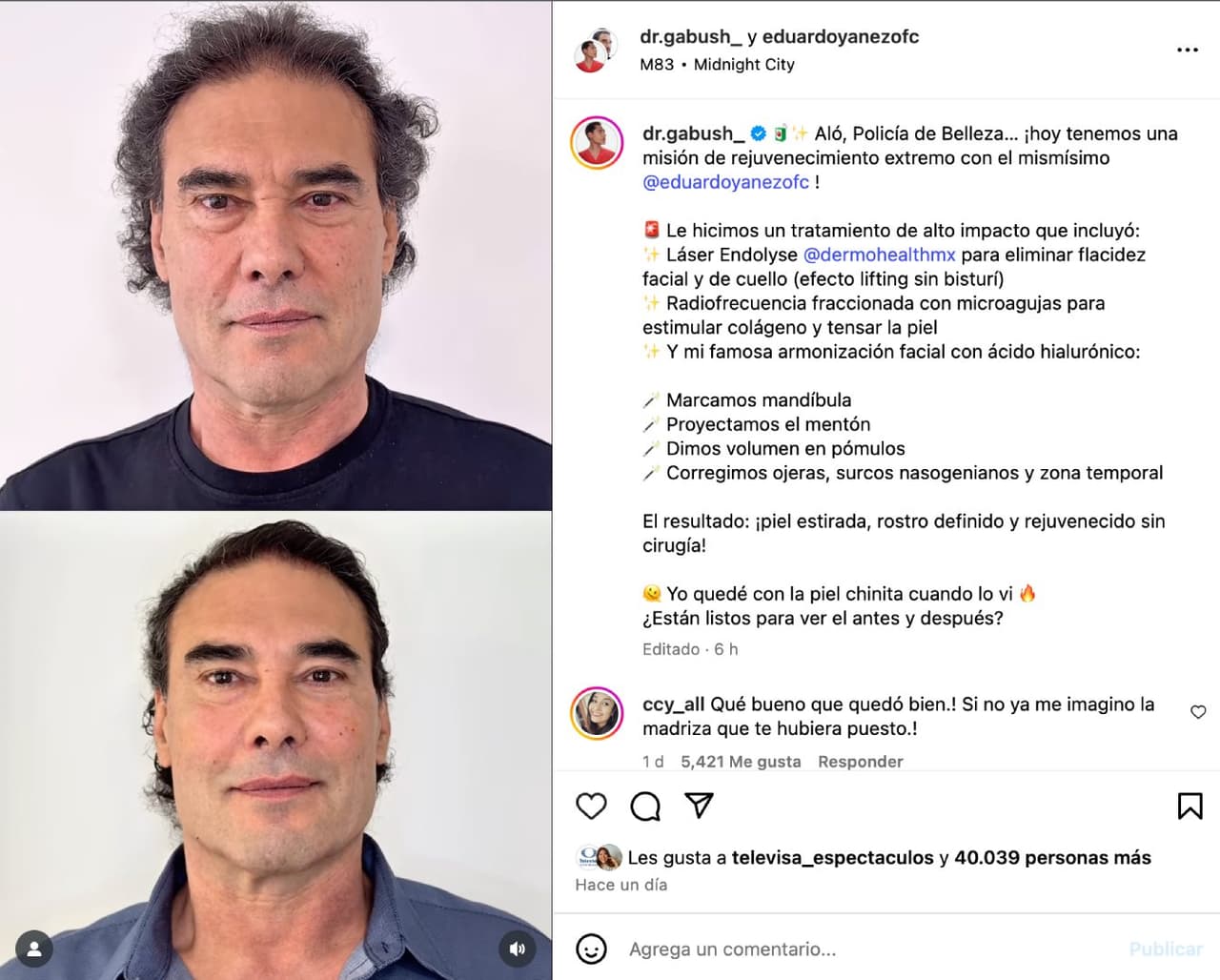 Eduardo Yáñez se somete a tratamiento para rejuvenecer.