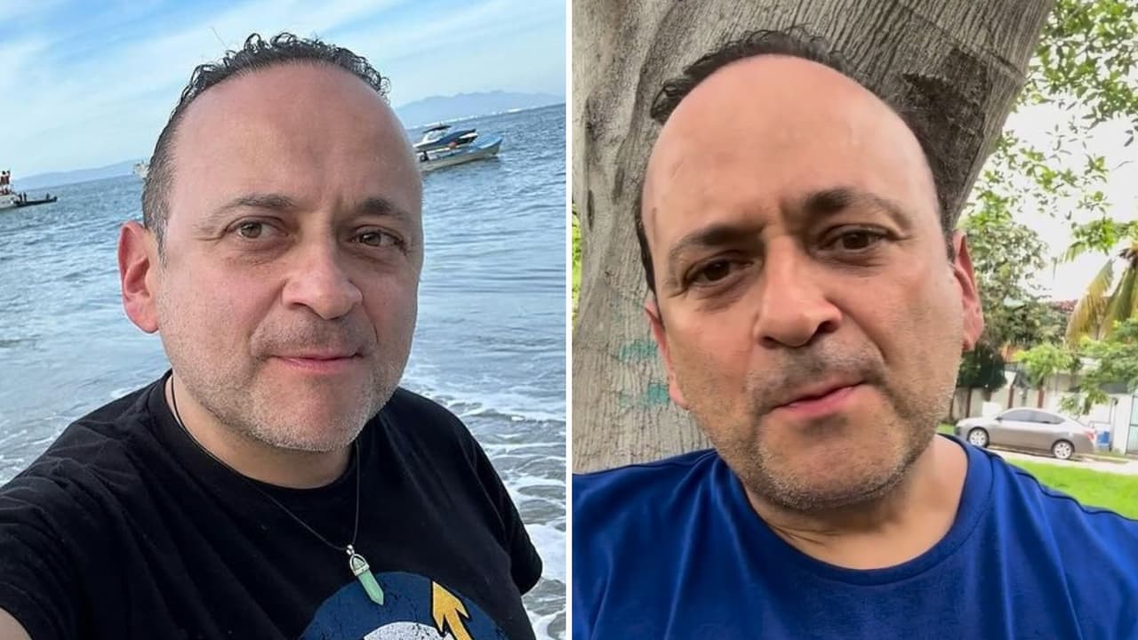¿Lalo España está perdiendo el oído? Él revela la enfermedad que tiene y que lo hizo deprimirse