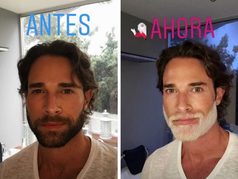 Antes y después