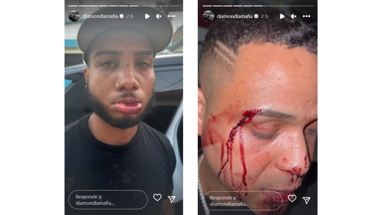 Diamond La Mafia reveló cómo quedaron sus colabores tras presunta golpiza de Tekashi 6ix9ine.