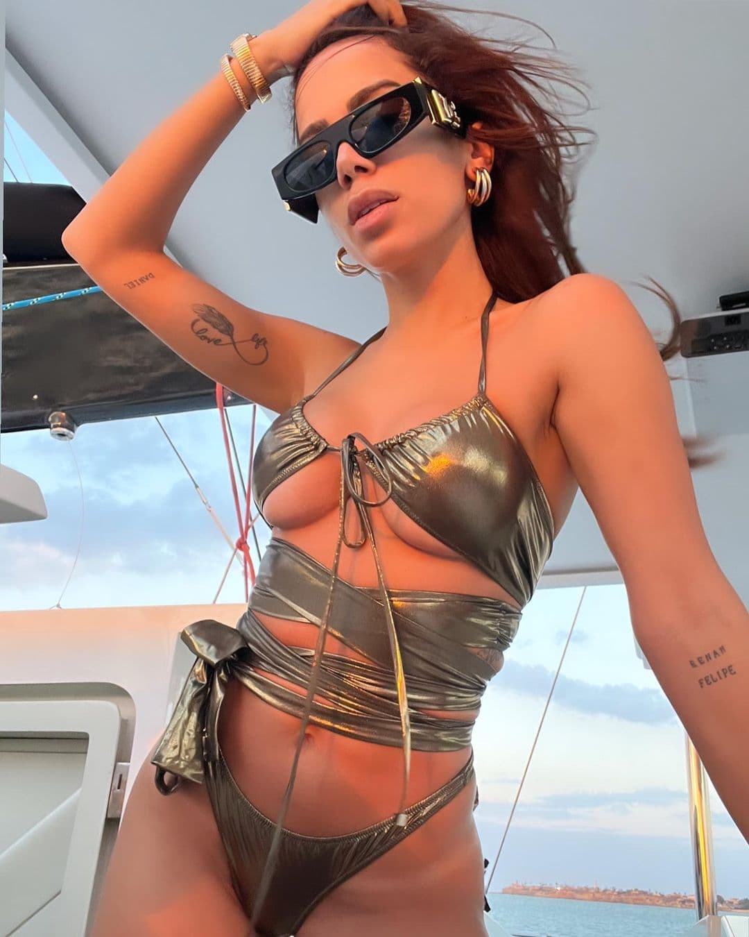 Anitta, ¿qué es 'endometriosis', padecimiento que la llevará al quirófano?