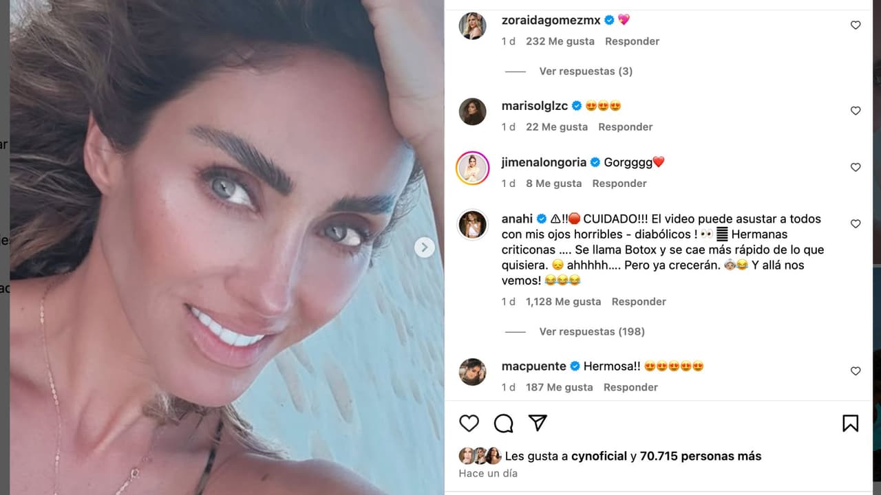 Anahí responde a críticas a su rostro.